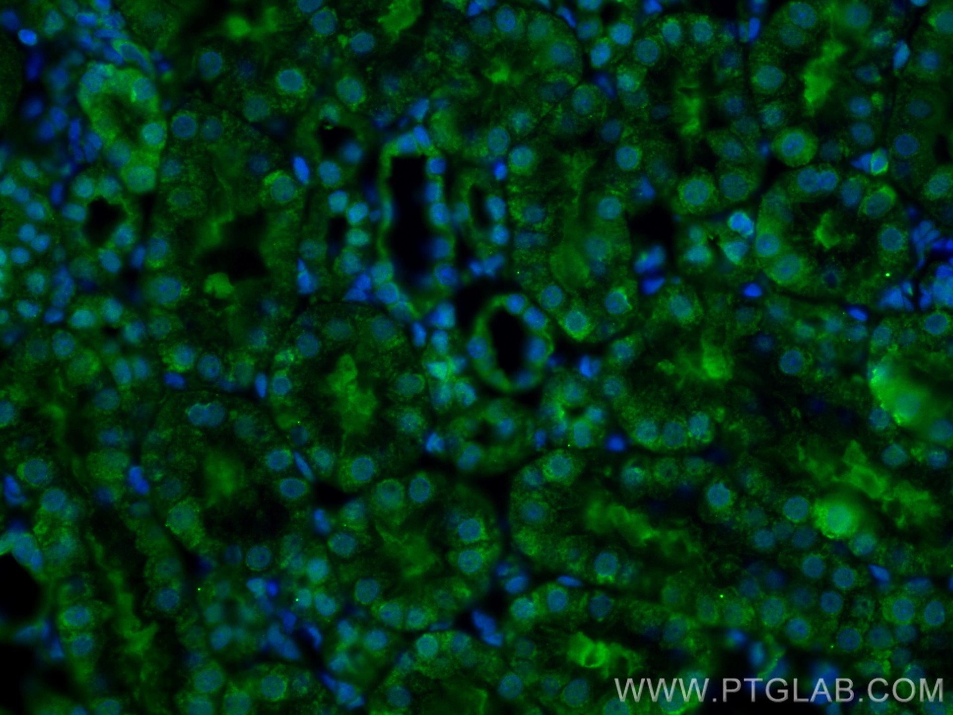 Immunofluorescence (IF) / fluorescent staining of rat kidney tissue using WWTR1/TAZ Polyclonal antibody (23306-1-AP)