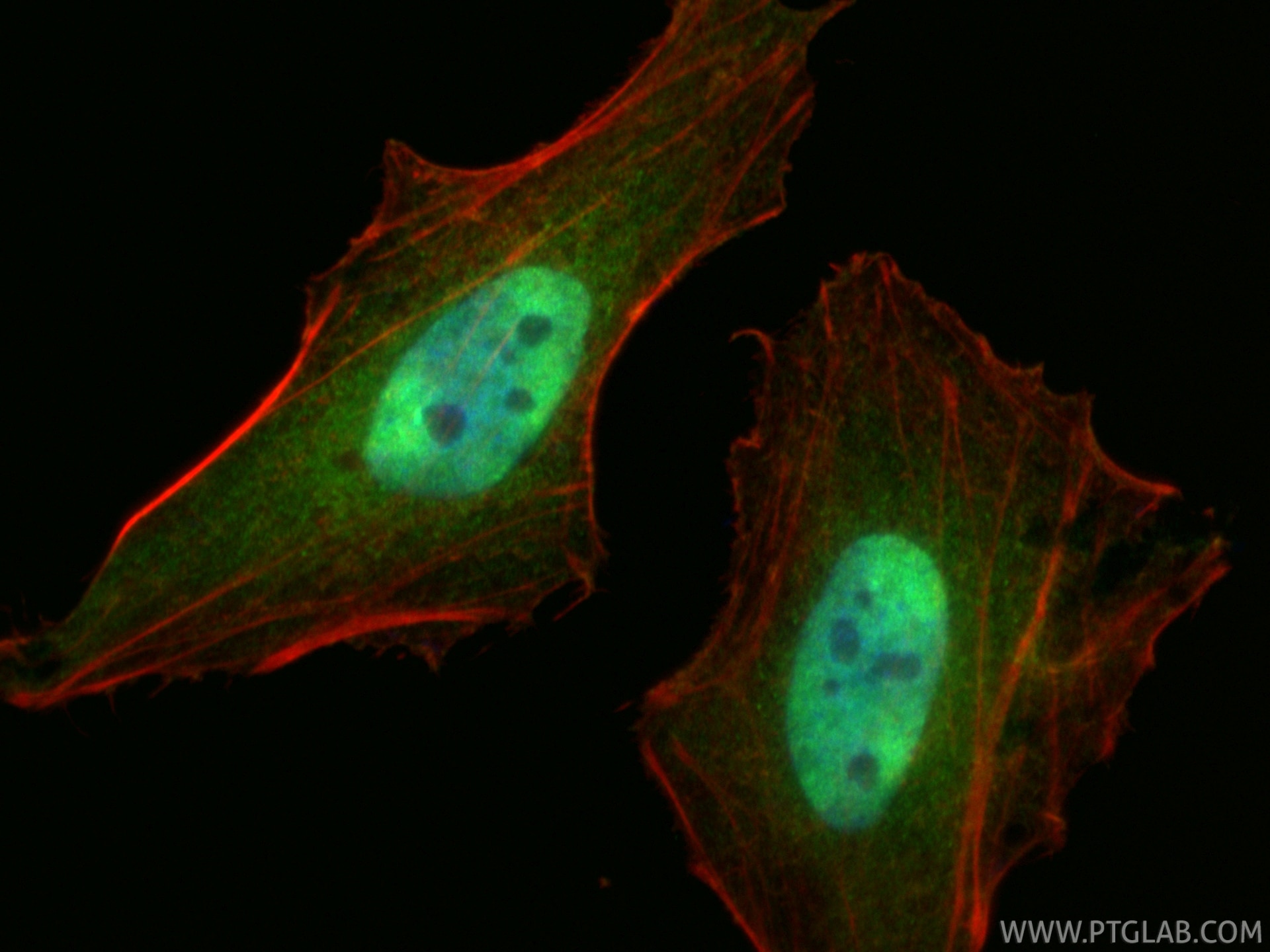 Immunofluorescence (IF) / fluorescent staining of HeLa cells using WWTR1/TAZ Polyclonal antibody (23306-1-AP)