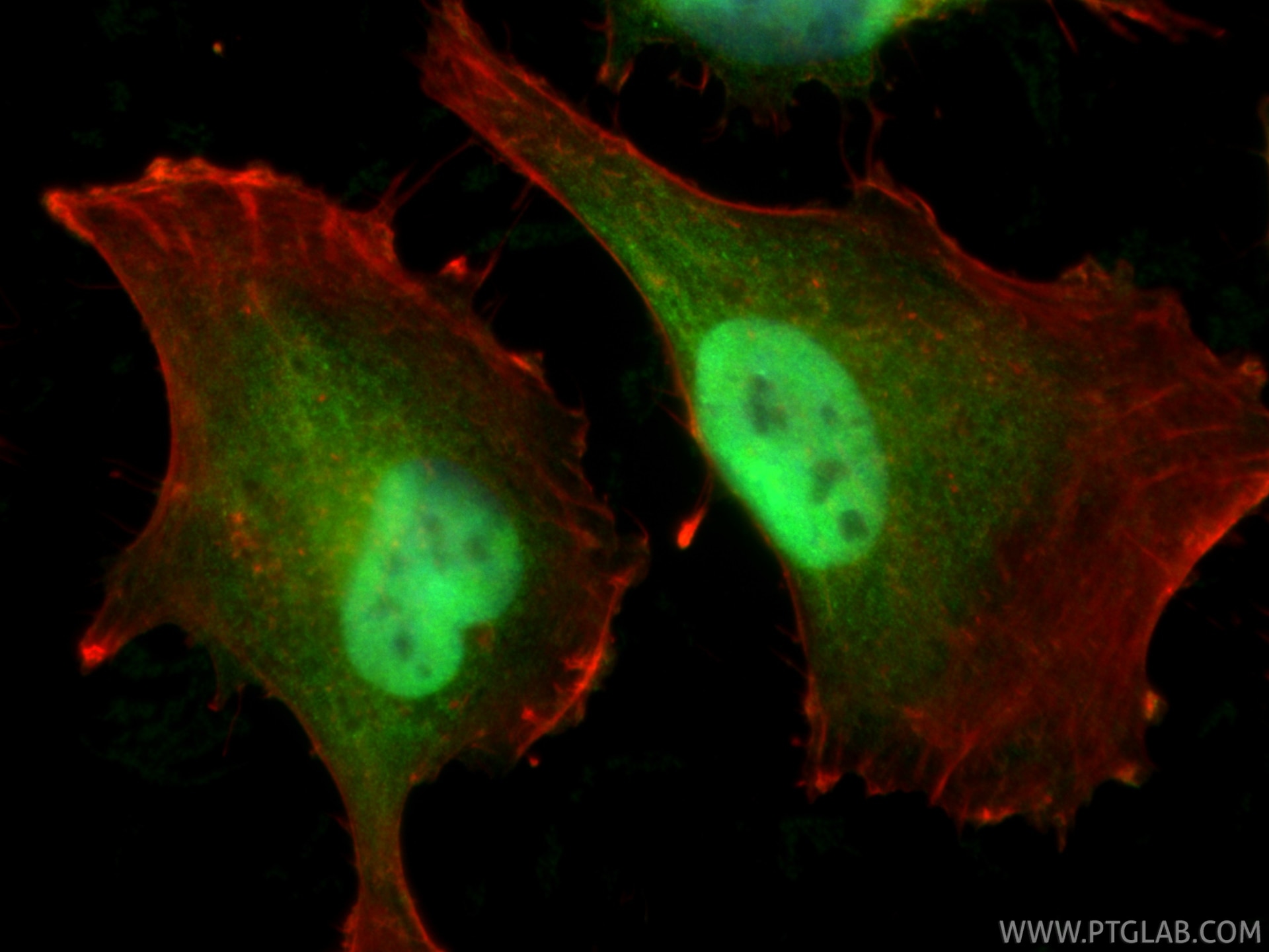 Immunofluorescence (IF) / fluorescent staining of U-251 cells using WWTR1/TAZ Polyclonal antibody (23306-1-AP)