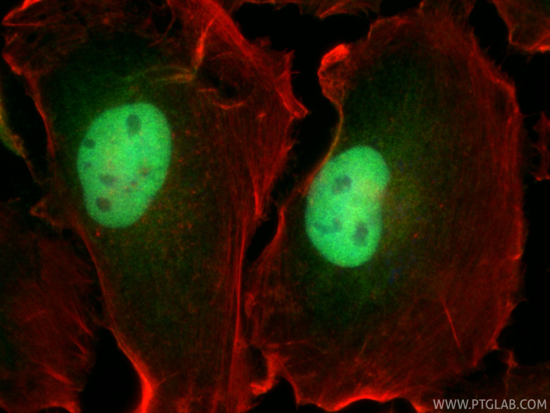 IF Staining of U-251 using 23306-1-AP Immunofluorescence (IF) / fluorescent staining of U-251 cells using WWTR1/TAZ Polyclonal antibody (23306-1-AP)