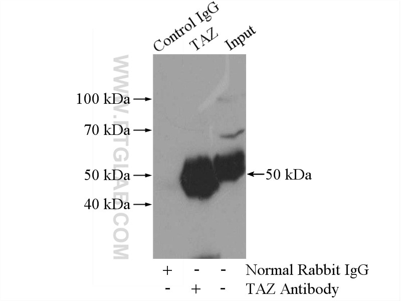 Immunoprecipitation (IP) experiment of MDA-MB-453s cells using WWTR1 Polyclonal antibody (23306-1-AP)