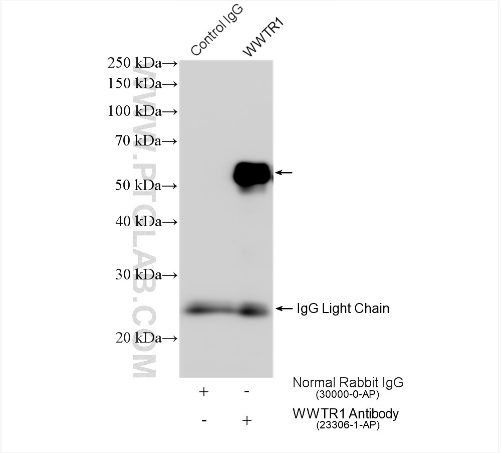 Immunoprecipitation (IP) experiment of MDA-MB-453s cells using WWTR1 Polyclonal antibody (23306-1-AP)