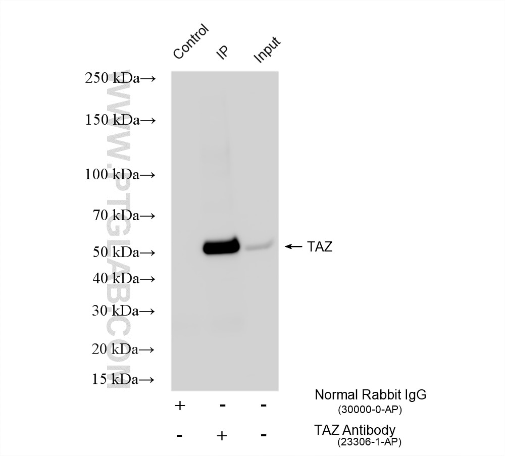 IP experiment of MDA-MB-453 using 23306-1-AP Immunoprecipitation (IP) experiment of MDA-MB-453 cells using WWTR1/TAZ Polyclonal antibody (23306-1-AP)