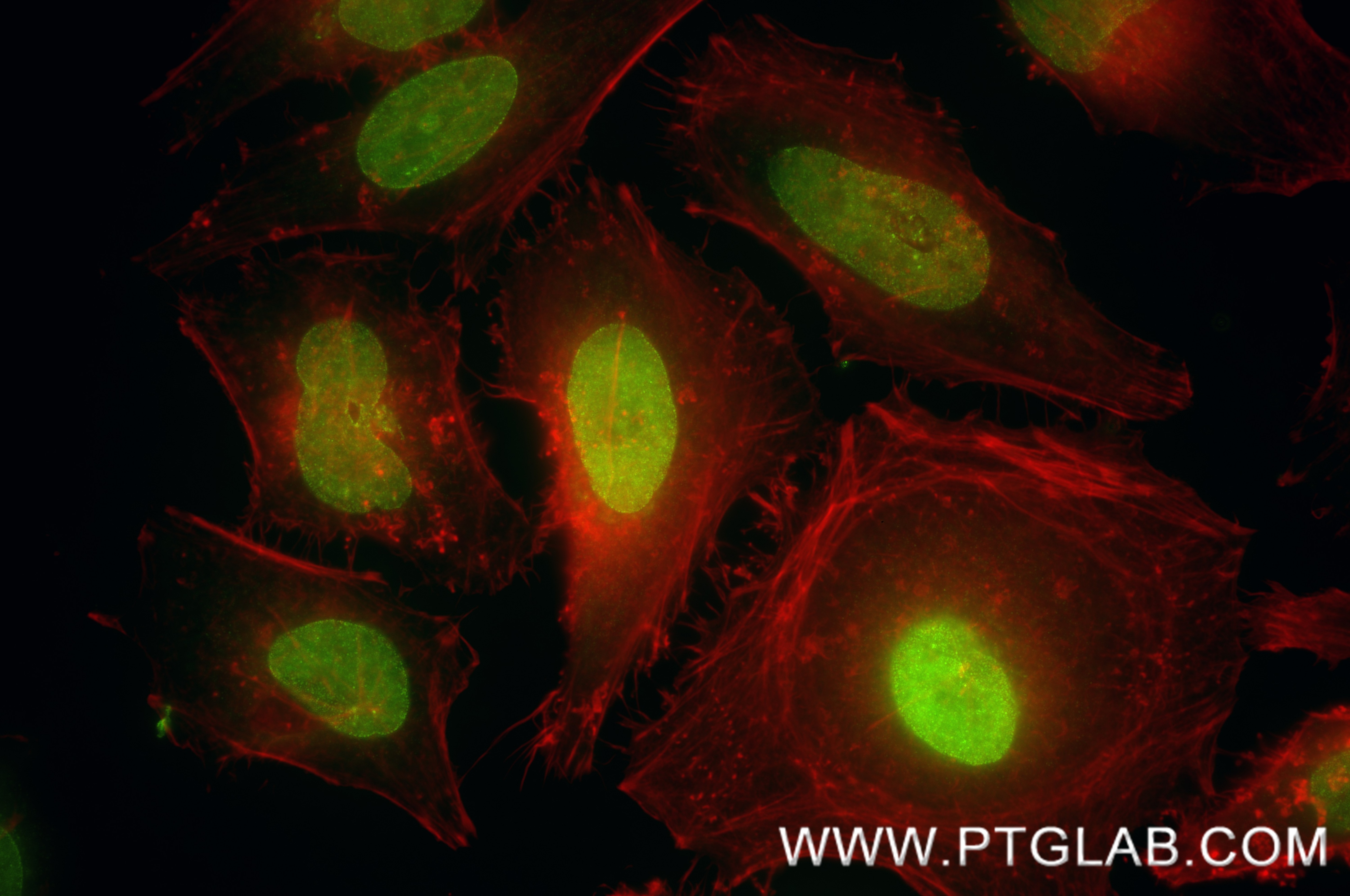 IF Staining of HeLa using 85245-5-RR Immunofluorescence (IF) / fluorescent staining of HeLa cells using WWTR1/TAZ Recombinant monoclonal antibody (85245-5-RR)