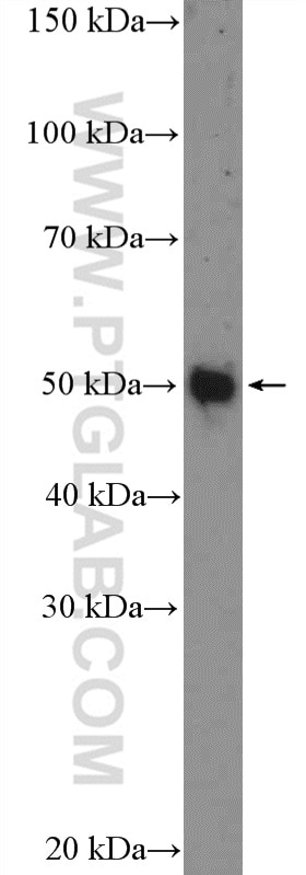 Western Blot (WB) analysis of COLO 320 cells using Whirlin Polyclonal antibody (25881-1-AP)
