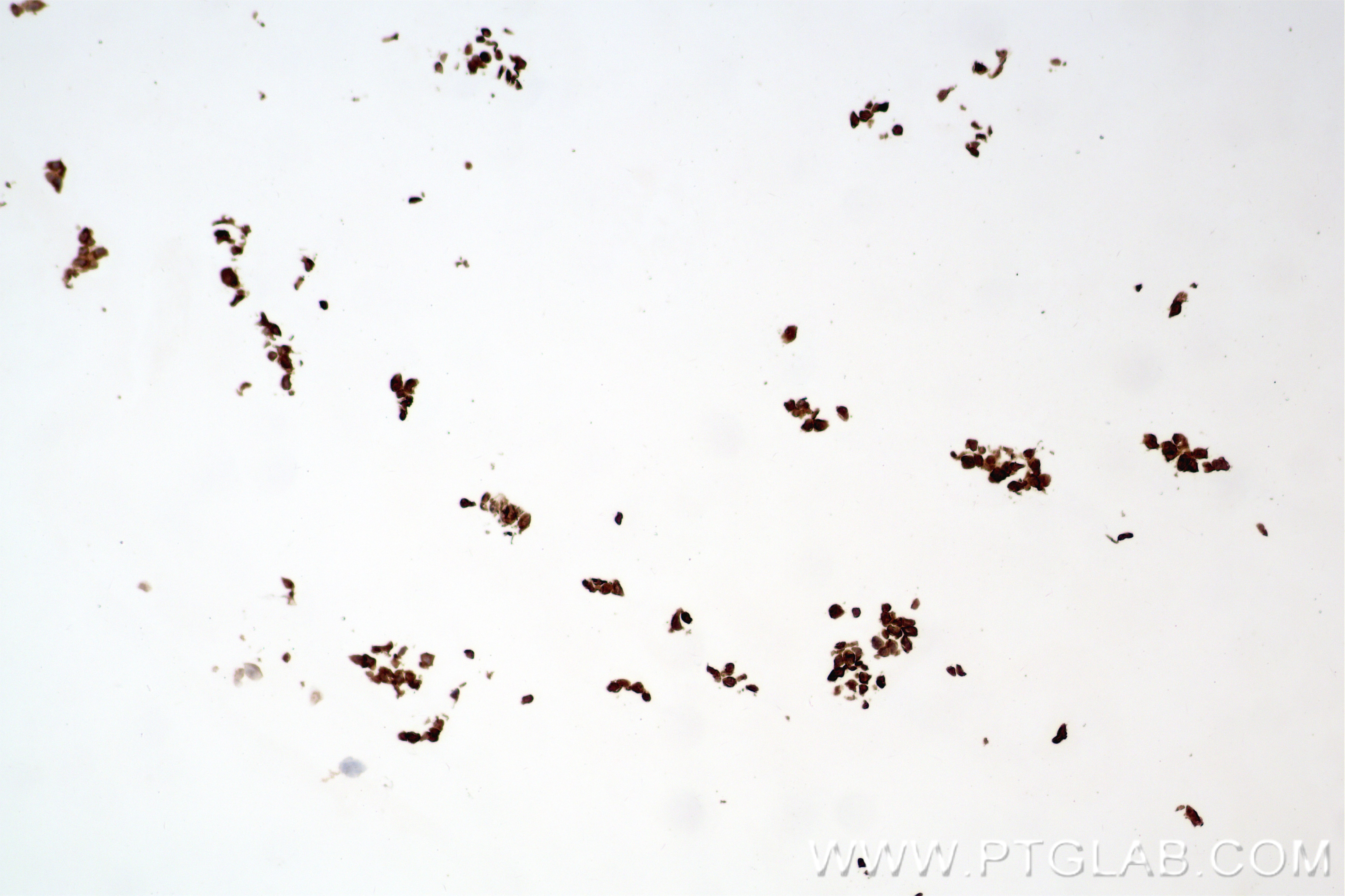Immunohistochemistry (IHC) staining of 293T cell（218Linker） using Anti-Whitlow/218 Linker Rabbit Recombinant Antibod (98672-3-RR)