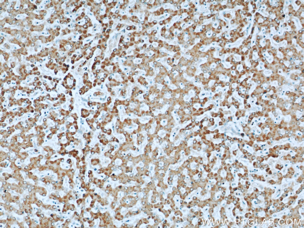 Immunohistochemistry (IHC) staining of human liver tissue using Willin Polyclonal antibody (21039-1-AP)
