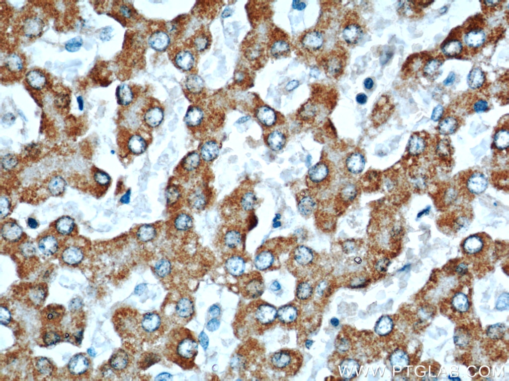 Immunohistochemistry (IHC) staining of human liver tissue using Willin Polyclonal antibody (21039-1-AP)