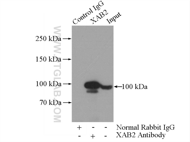 Immunoprecipitation (IP) experiment of K-562 cells using XAB2 Polyclonal antibody (10637-1-AP)