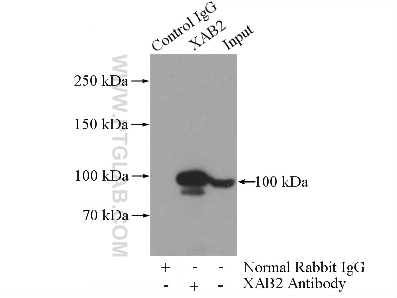 XAB2