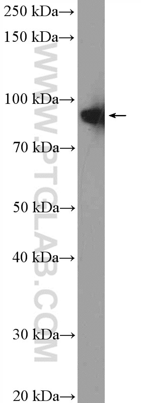 Western Blot (WB) analysis of HeLa cells using XAB2 Polyclonal antibody (10637-1-AP)