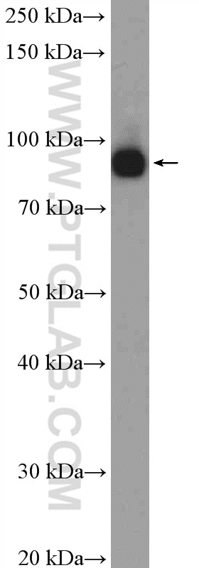 Western Blot (WB) analysis of HeLa cells using XAB2 Polyclonal antibody (10637-1-AP)