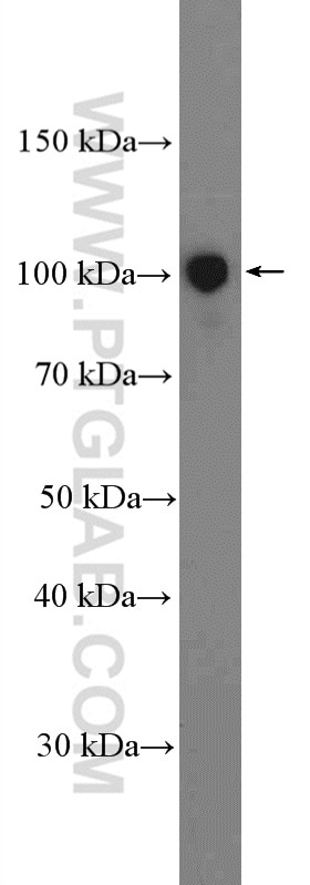 Western Blot (WB) analysis of K-562 cells using XAB2 Polyclonal antibody (10637-1-AP)