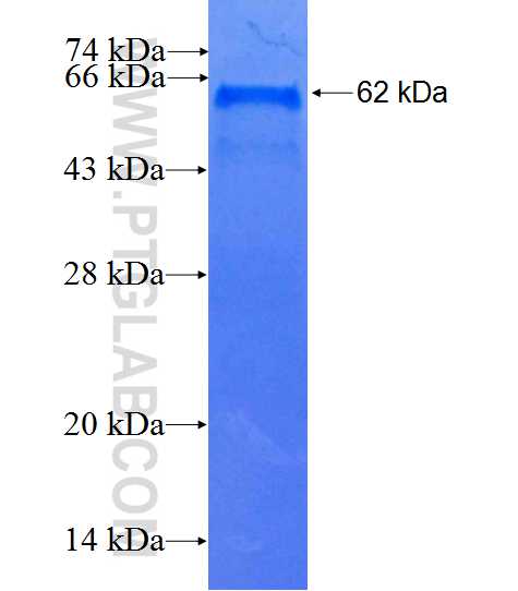 XAB2 fusion protein Ag0999 SDS-PAGE