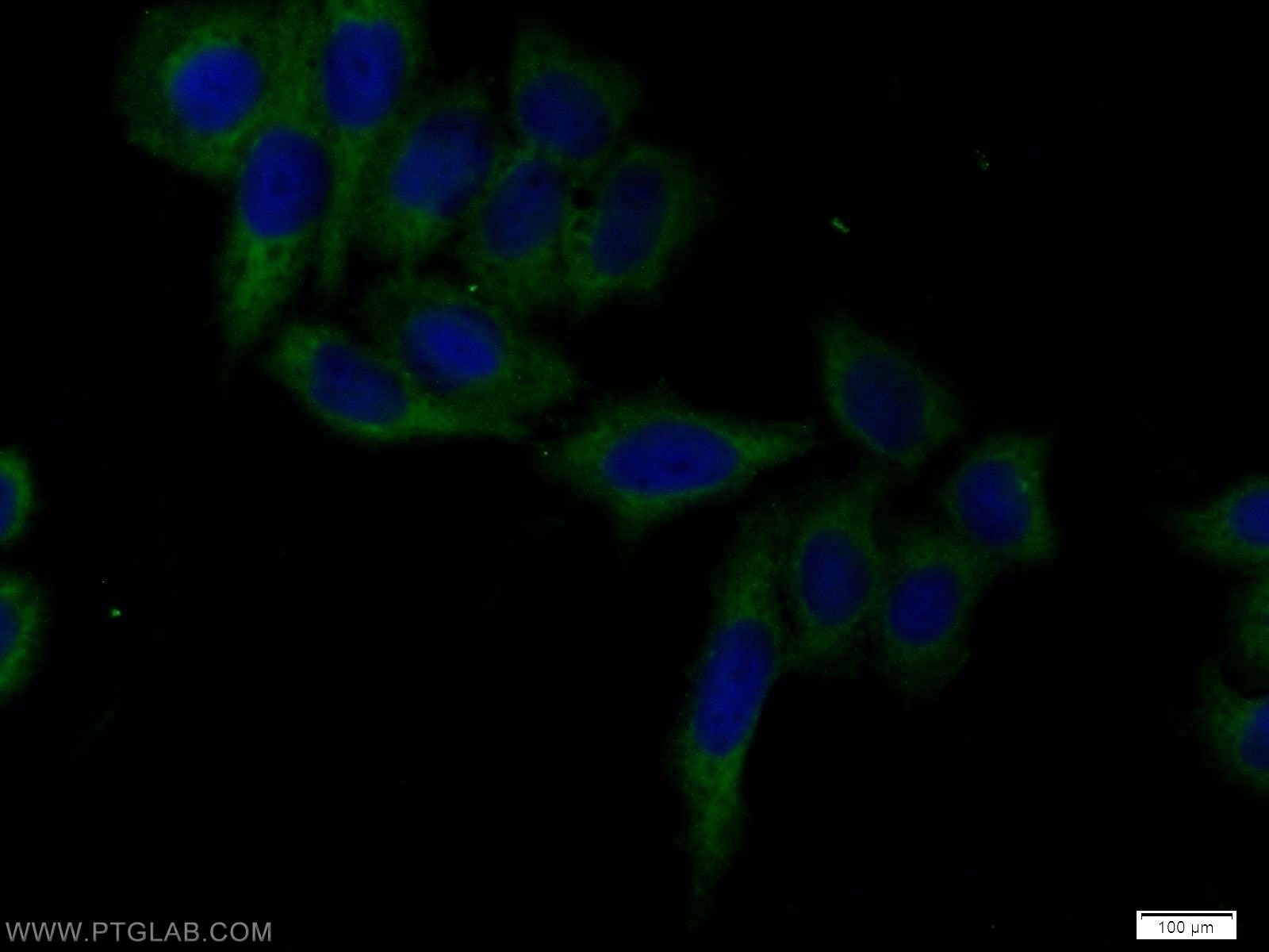 Immunofluorescence (IF) / fluorescent staining of HeLa cells using XAF1 Polyclonal antibody (17837-1-AP)