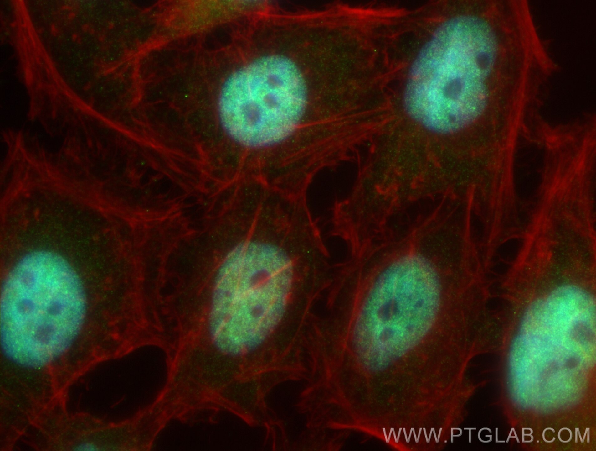 Immunofluorescence (IF) / fluorescent staining of HeLa cells using XAGE2 Polyclonal antibody (33118-1-AP)