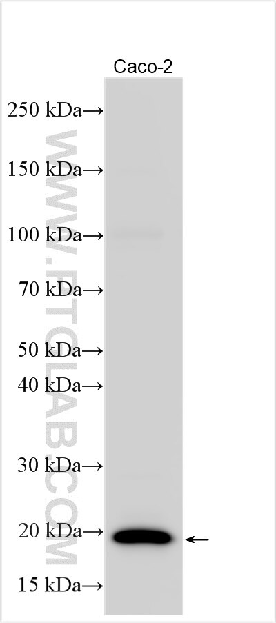 Western Blot (WB) analysis of various lysates using XAGE2 Polyclonal antibody (33118-1-AP)
