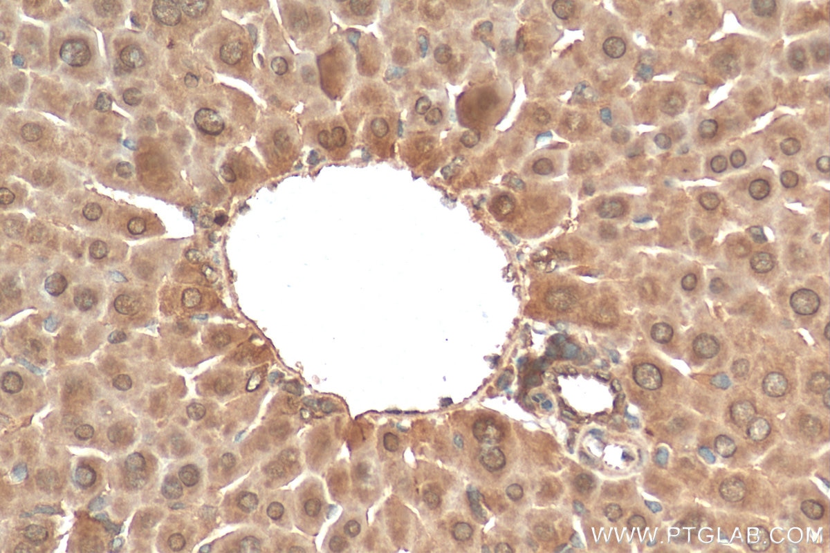 Immunohistochemistry (IHC) staining of mouse liver tissue using XBP1S/XBP1U Polyclonal antibody (24168-1-AP)