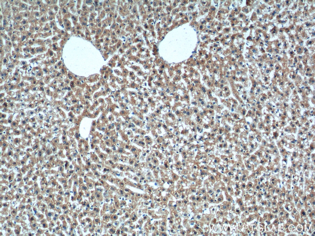 Immunohistochemistry (IHC) staining of mouse liver tissue using XBP1S/XBP1U Polyclonal antibody (24168-1-AP)