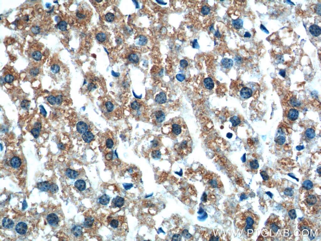 Immunohistochemistry (IHC) staining of mouse liver tissue using XBP1S/XBP1U Polyclonal antibody (24168-1-AP)