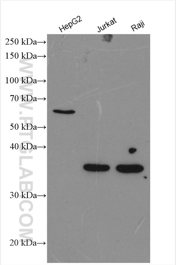 Western Blot (WB) analysis of various lysates using XBP1S/XBP1U Polyclonal antibody (24168-1-AP)