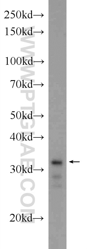 Western Blot (WB) analysis of HEK-293 cells using XBP1S/XBP1U Polyclonal antibody (24168-1-AP)