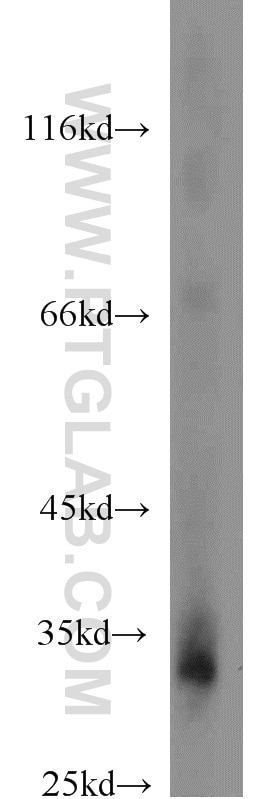 WB analysis of HepG2 using 24168-1-AP