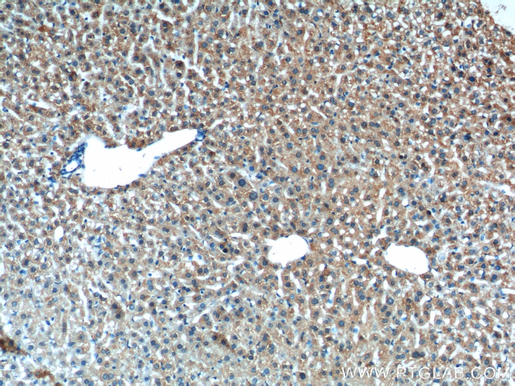 Immunohistochemistry (IHC) staining of mouse liver tissue using XBP-1U specific Polyclonal antibody (25997-1-AP)