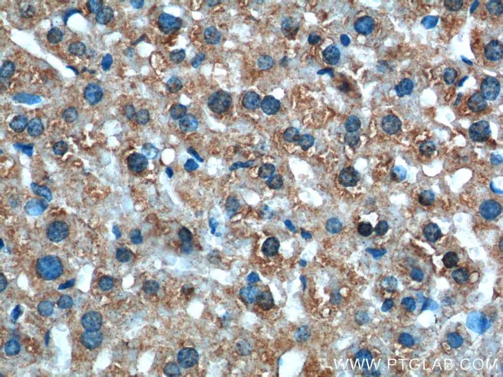 Immunohistochemistry (IHC) staining of mouse liver tissue using XBP-1U specific Polyclonal antibody (25997-1-AP)