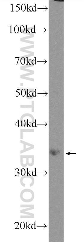 XBP-1U specific