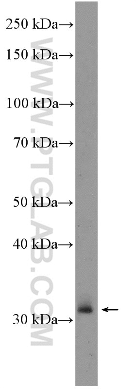 Western Blot (WB) analysis of rat spleen tissue using XBP-1U specific Polyclonal antibody (25997-1-AP)
