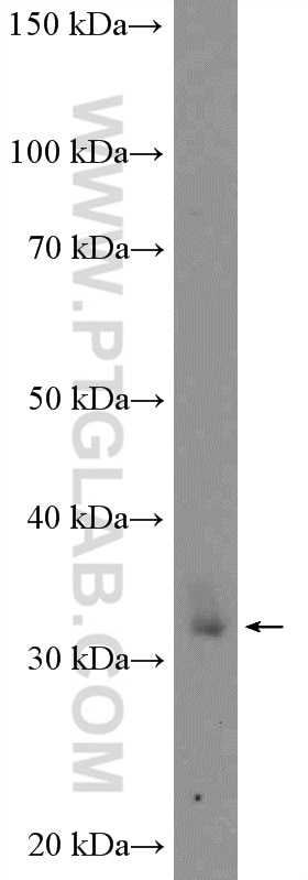 Western Blot (WB) analysis of rat spleen tissue using XBP-1U specific Polyclonal antibody (25997-1-AP)