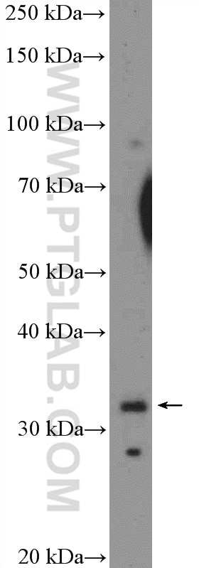 Western Blot (WB) analysis of mouse spleen tissue using XBP-1U specific Polyclonal antibody (25997-1-AP)