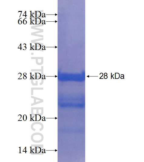 XBP1 fusion protein Ag21454 SDS-PAGE