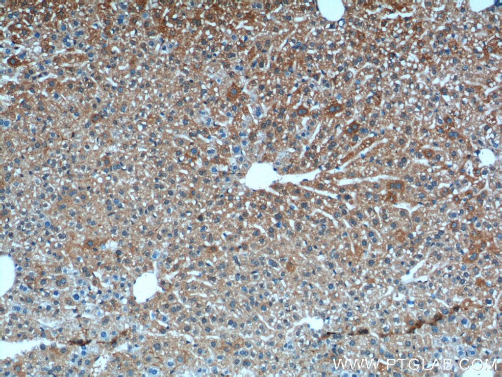 Immunohistochemistry (IHC) staining of mouse liver tissue using XBP1S-specific Polyclonal antibody (24868-1-AP)