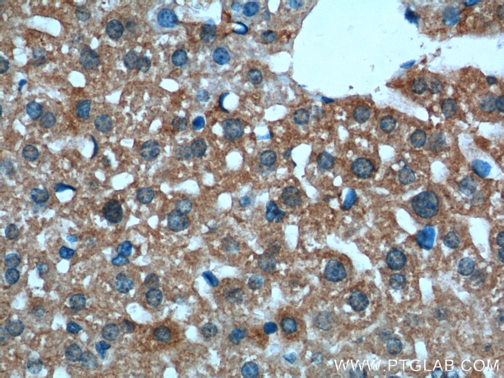 IHC staining of mouse liver using 24868-1-AP