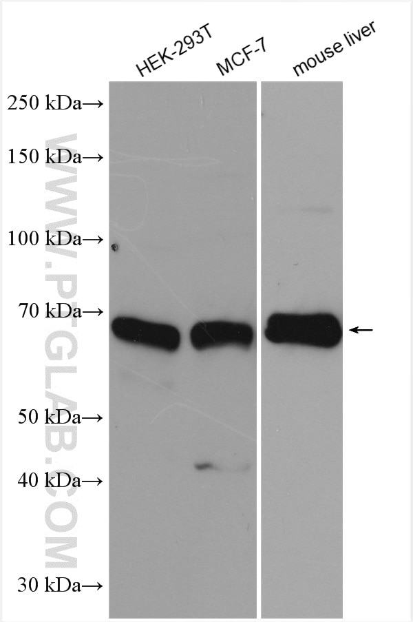 Western Blot (WB) analysis of various lysates using XBP1S-specific Polyclonal antibody (24868-1-AP)