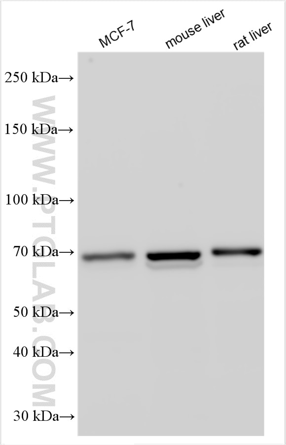 Western Blot (WB) analysis of various lysates using XBP1S-specific Polyclonal antibody (24868-1-AP)
