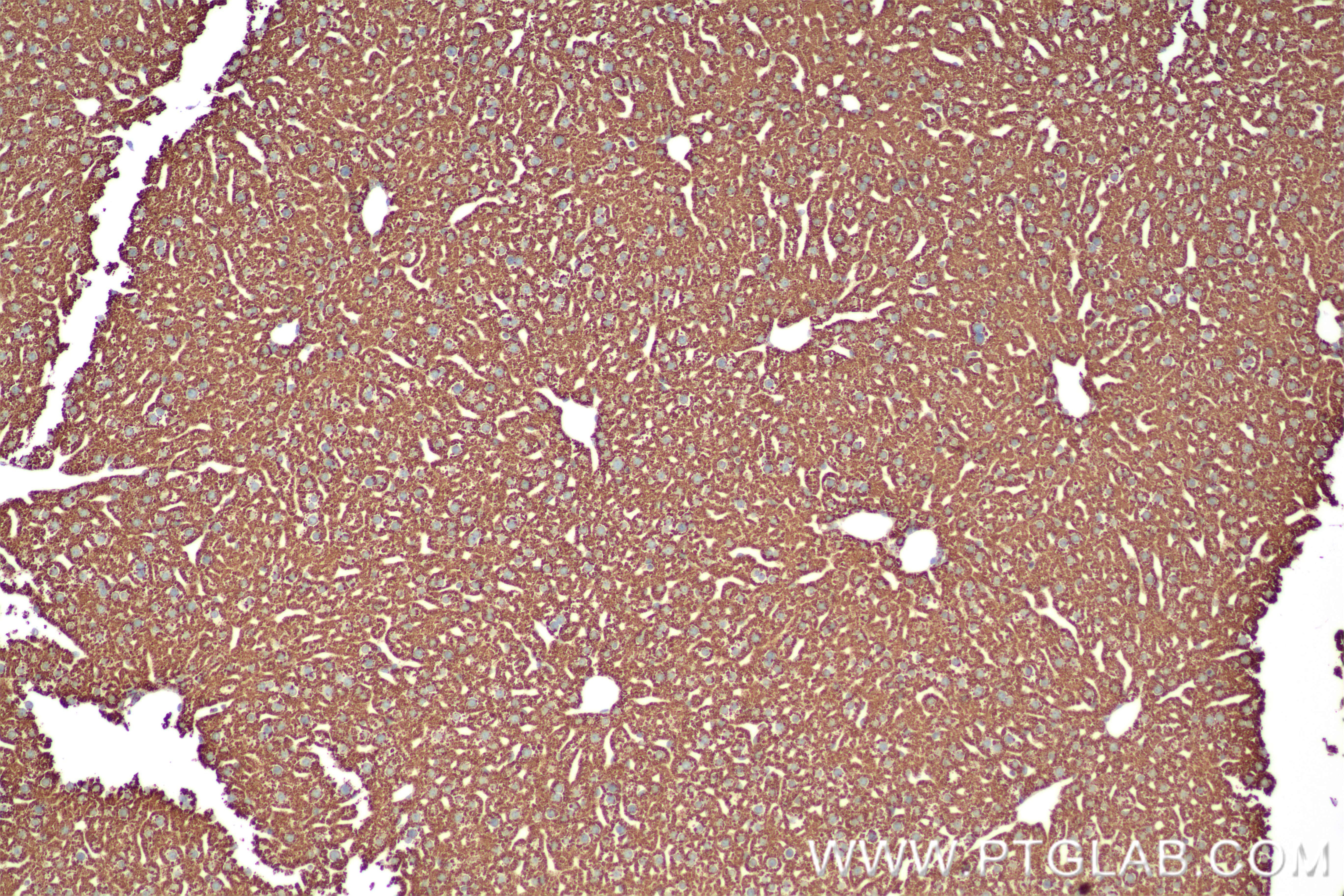 Immunohistochemistry (IHC) staining of mouse liver tissue using XBP1S-specific Recombinant monoclonal antibody (83959-5-RR)