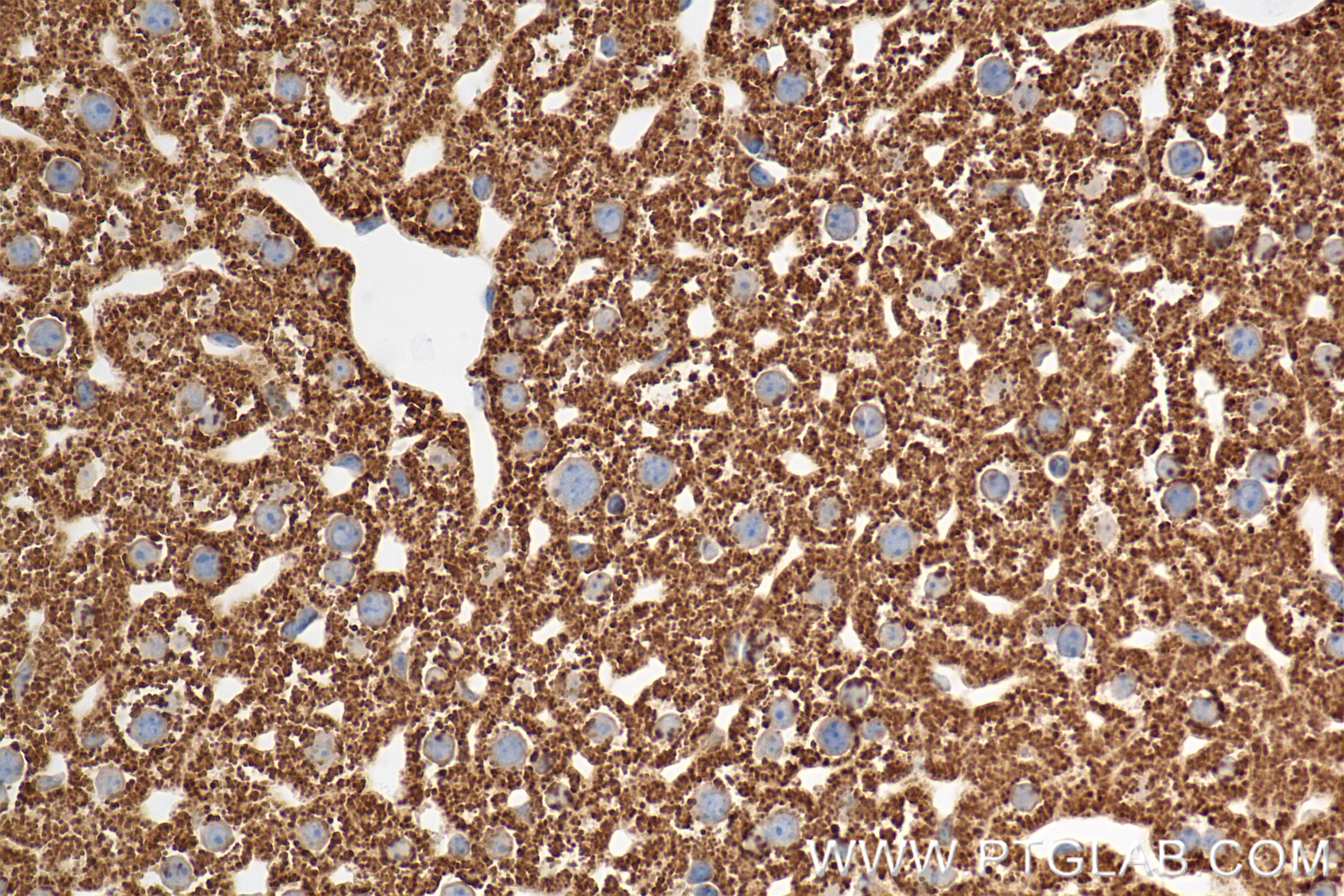 Immunohistochemistry (IHC) staining of mouse liver tissue using XBP1S-specific Recombinant monoclonal antibody (83959-5-RR)