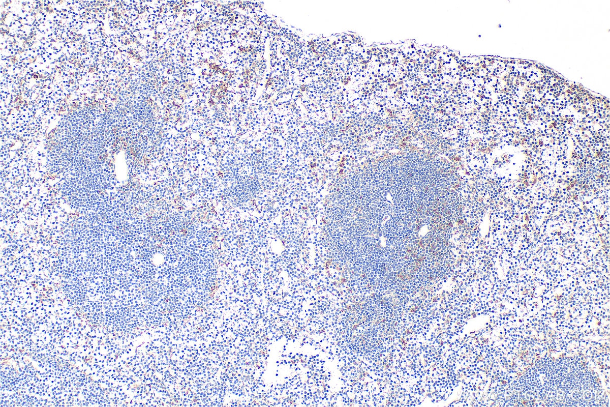Immunohistochemical analysis of paraffin-embedded mouse spleen tissue slide using 33408-1-AP (XCL1 antibody) at dilution of 1:400 (under 10x lens). Heat mediated antigen retrieval with Tris-EDTA buffer (pH 9.0). Immunohistochemistry (IHC) staining of mouse spleen tissue using XCL1 Polyclonal antibody (33408-1-AP)