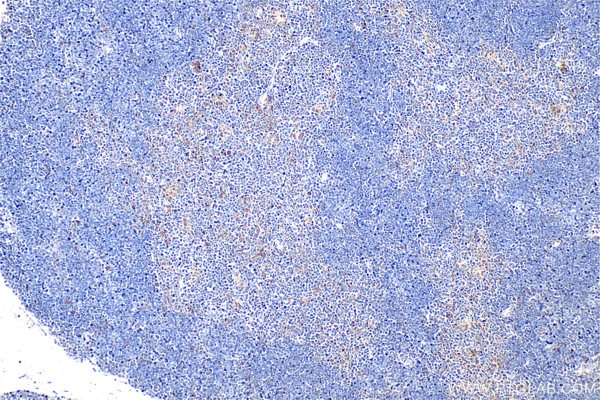 Immunohistochemical analysis of paraffin-embedded mouse thymus tissue slide using 33408-1-AP (XCL1 antibody) at dilution of 1:400 (under 10x lens). Heat mediated antigen retrieval with Tris-EDTA buffer (pH 9.0). Immunohistochemistry (IHC) staining of mouse thymus tissue using XCL1 Polyclonal antibody (33408-1-AP)