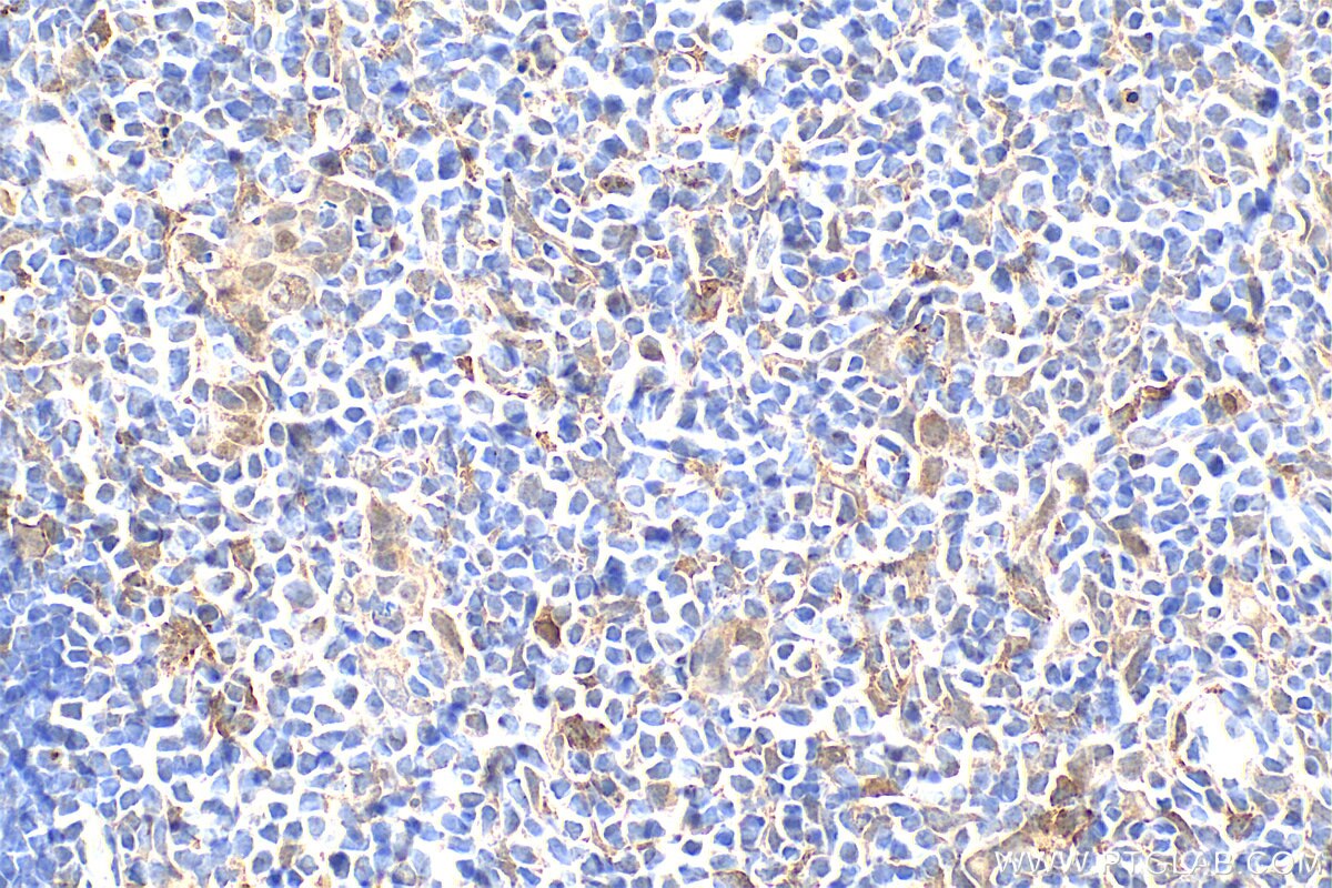 Immunohistochemical analysis of paraffin-embedded mouse thymus tissue slide using 33408-1-AP (XCL1 antibody) at dilution of 1:400 (under 40x lens). Heat mediated antigen retrieval with Tris-EDTA buffer (pH 9.0). Immunohistochemistry (IHC) staining of mouse thymus tissue using XCL1 Polyclonal antibody (33408-1-AP)