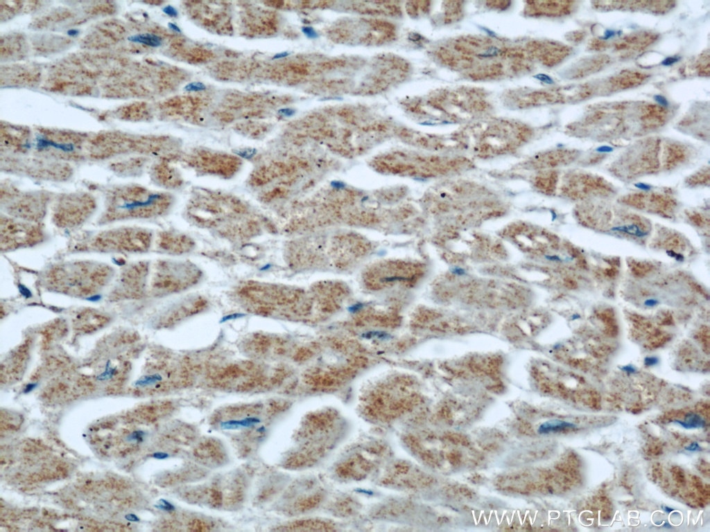 Immunohistochemistry (IHC) staining of human heart tissue using XDH Polyclonal antibody (55156-1-AP)