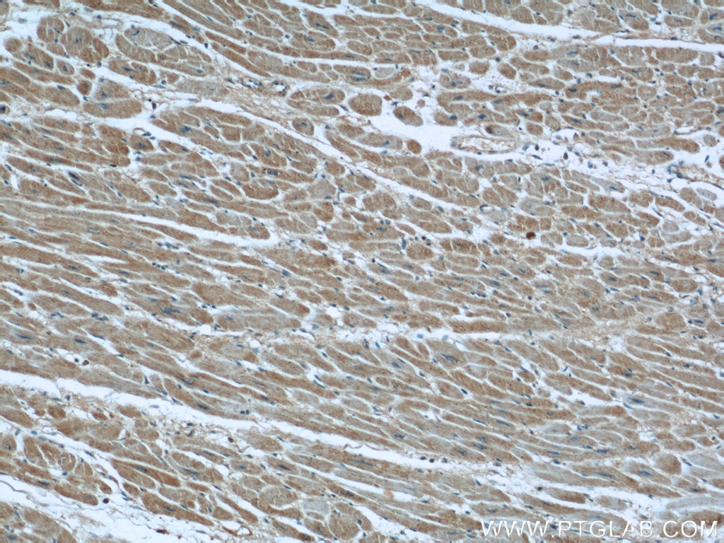 Immunohistochemistry (IHC) staining of human heart tissue using XDH Polyclonal antibody (55156-1-AP)