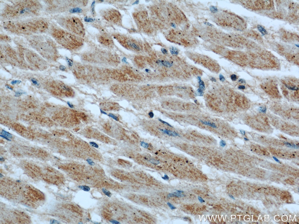 Immunohistochemistry (IHC) staining of human heart tissue using XDH Polyclonal antibody (55156-1-AP)