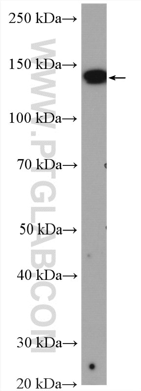 Western Blot (WB) analysis of rat liver tissue using XDH Polyclonal antibody (55156-1-AP)