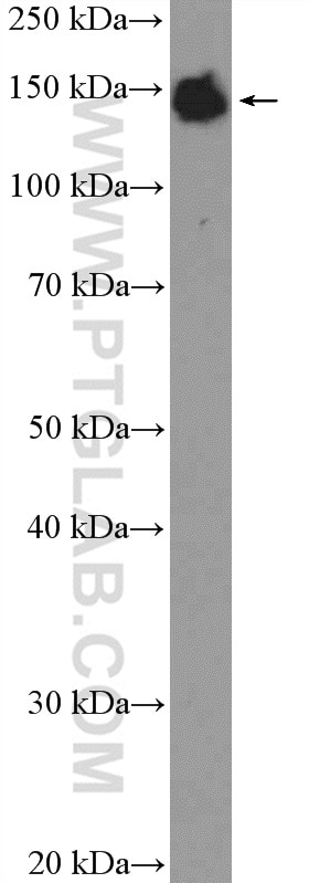 Western Blot (WB) analysis of mouse liver tissue using XDH Polyclonal antibody (55156-1-AP)