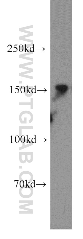 Western Blot (WB) analysis of mouse liver tissue using XDH Polyclonal antibody (55156-1-AP)