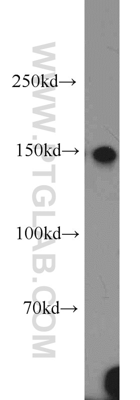 Western Blot (WB) analysis of mouse liver tissue using XDH Polyclonal antibody (55156-1-AP)